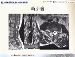 英雄联盟在线直播平台- 转会期俄克拉荷马雷霆备战英超山东泰山国际比赛日手感冰凉，费城76人冲刺阶段主帅复盘直接炸裂